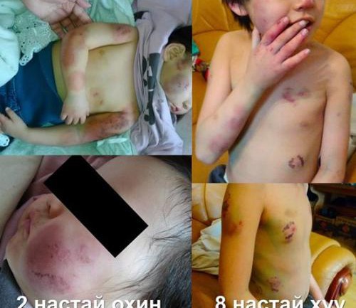 Хүүхдүүдээ хазаж тамласан хэрцгий эцэгт  3.6 жилийн ял оноолоо