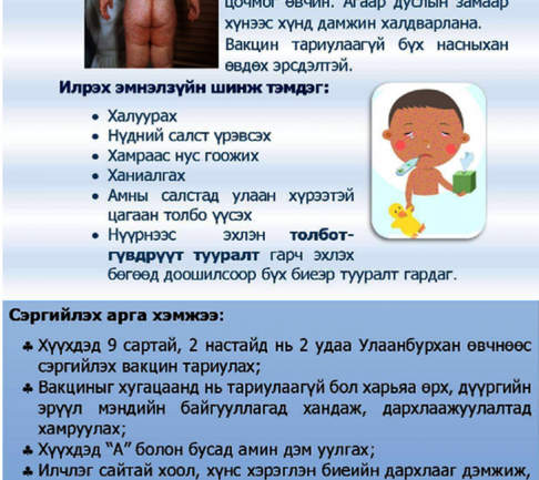 Улаанбурхан өвчний 13267 сэжигтэй тохиолдол бүртгэгджээ