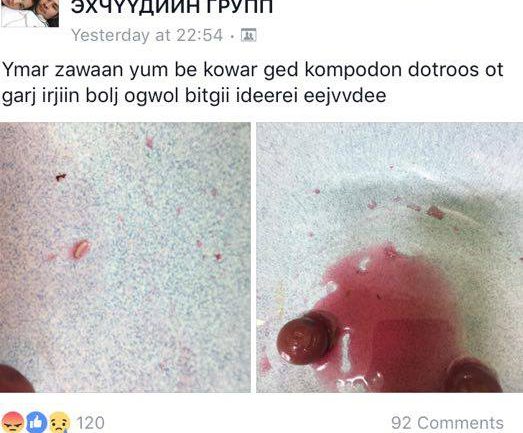 “Баясах трэйд” ХХК-ийн оруулж ирдэг “Kowar” компотноос  дахин өт гарлаа гэв